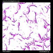 sporulating clostridium